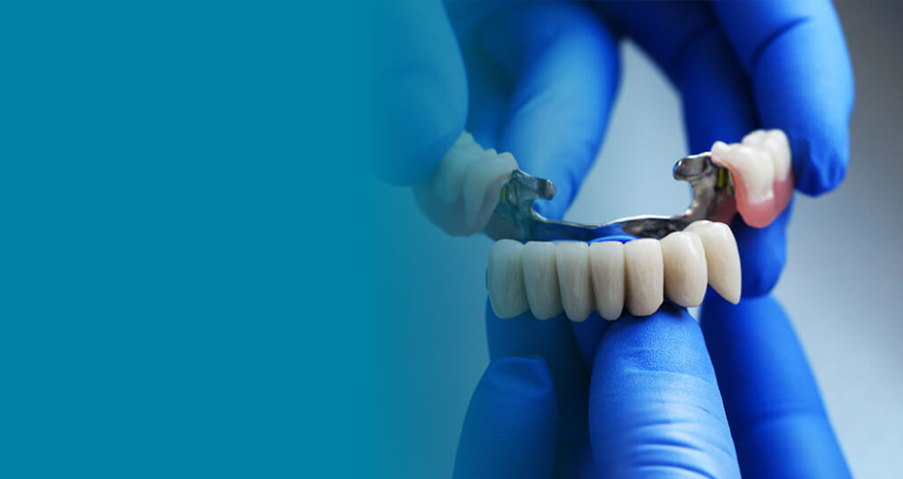 Dental Bridges Vista CA