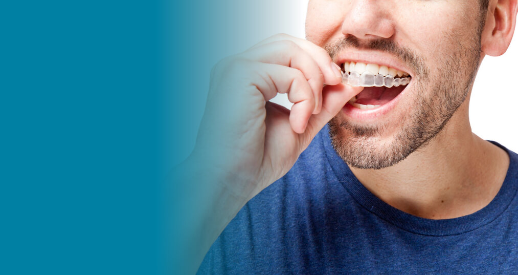 Invisalign Dentist Vista CA