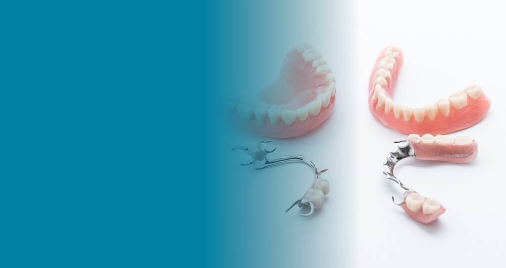Dentures and Partial Dentures